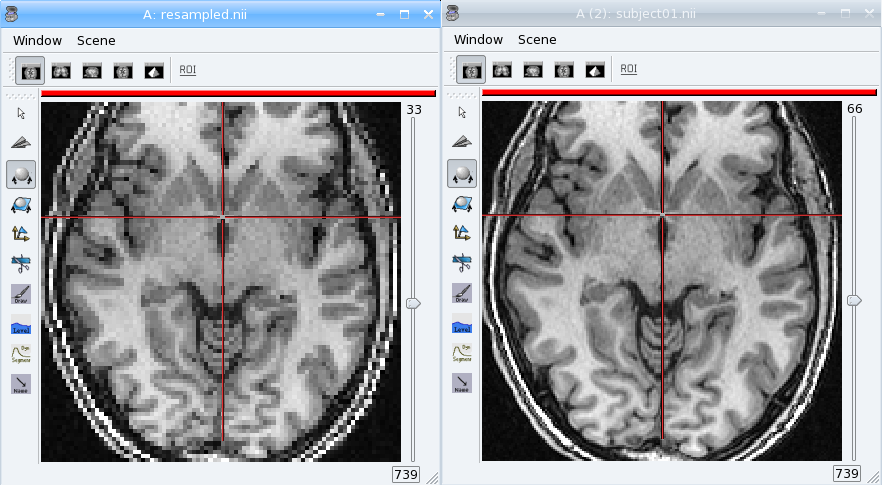 Downsampled anatomical image