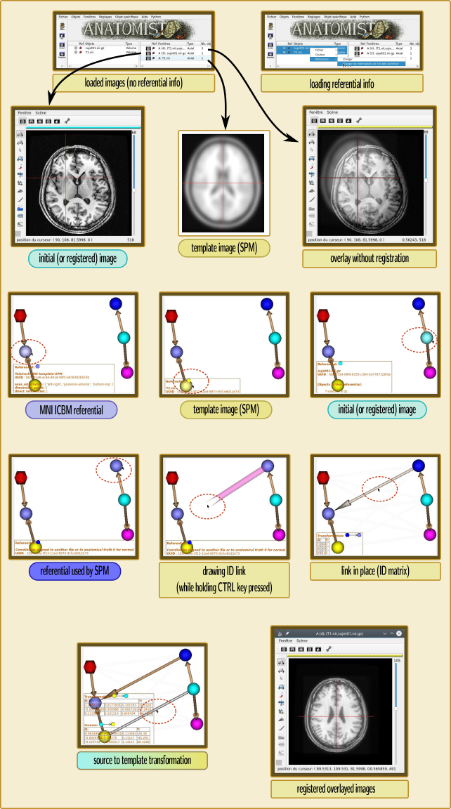 _images/spm_anatomist.png