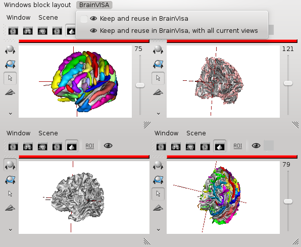 _images/reusable_anatomist_block.png