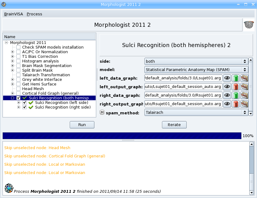 _images/sulci_recognition.png