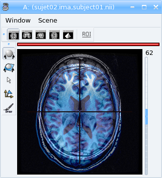 _images/fusion_2_subjects.png