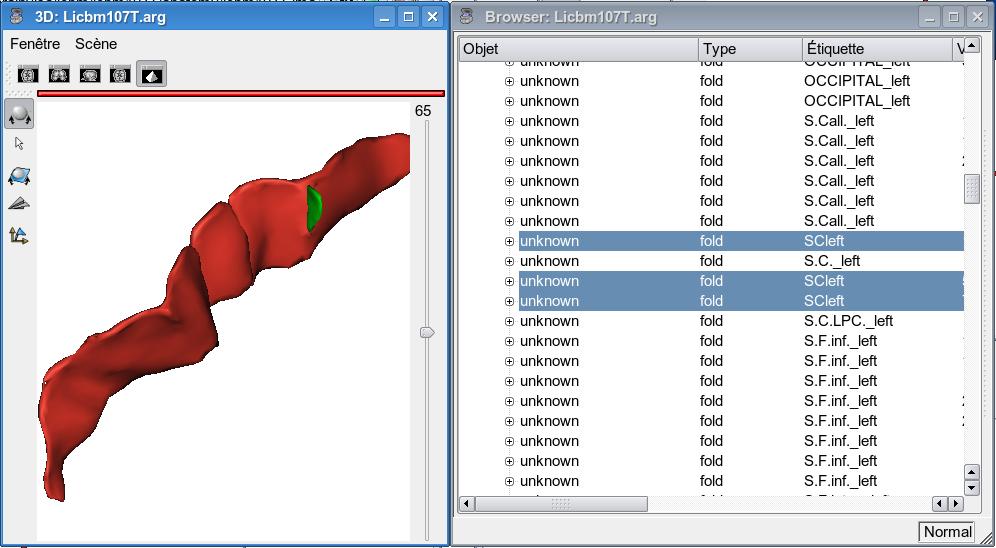 Central sulcus without branches