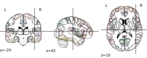 _images/atlas_sulci_small.jpg