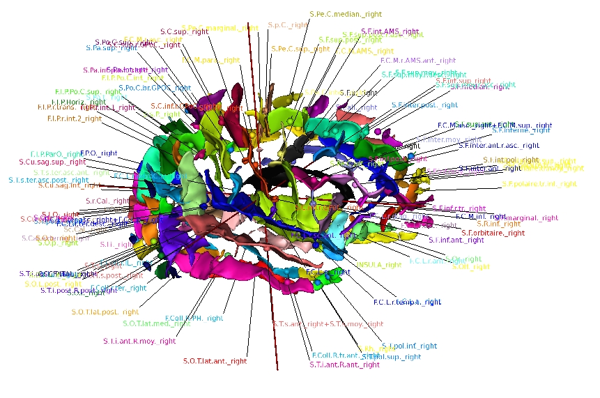 _images/graphannotate.jpg