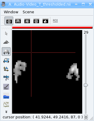 Thresholded Audio-Video T-map