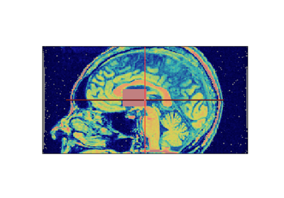 ../_images/sphx_glr_aimsvolumetest_thumb.png
