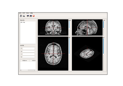 ../_images/sphx_glr_anaevensimplerviewer_thumb.png