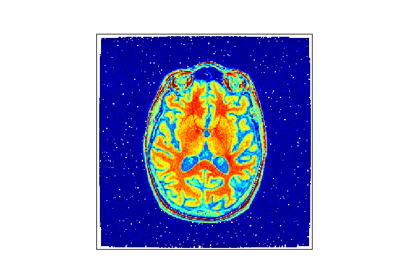 ../_images/sphx_glr_volumetest_thumb.png