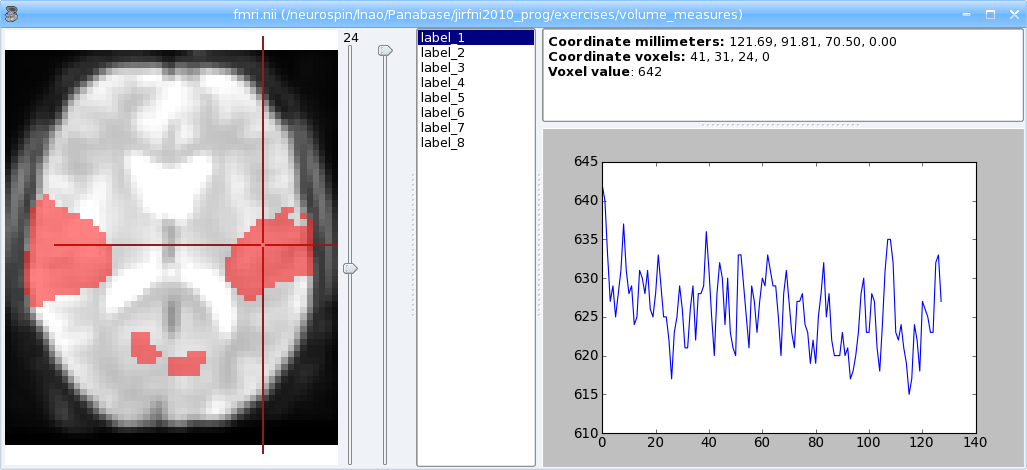 _images/volume_measures.png