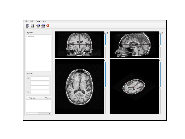 anaevensimplerviewer