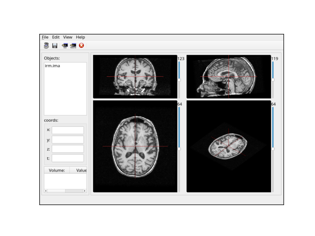 anaevensimplerviewer