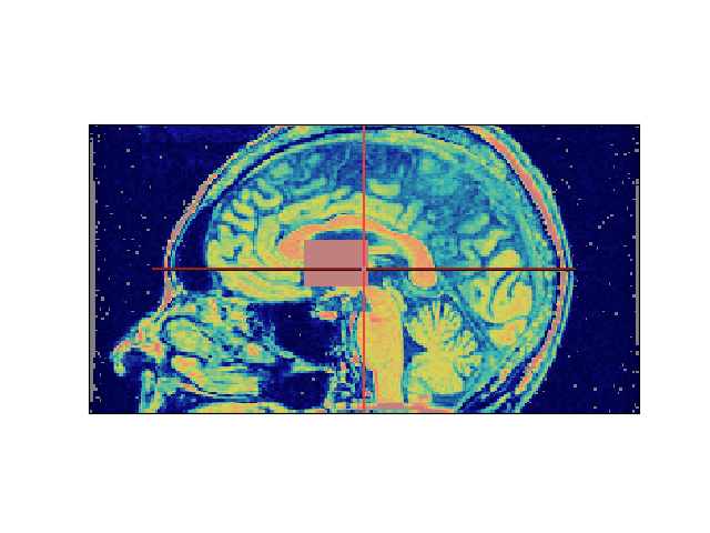 ../_images/sphx_glr_aimsvolumetest_001.png