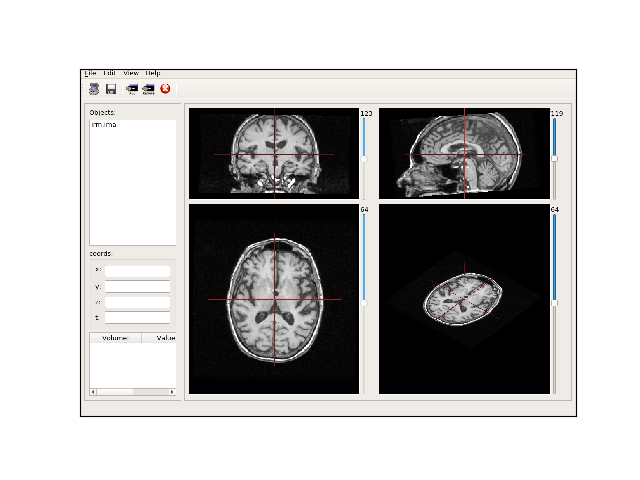 ../_images/sphx_glr_anaevensimplerviewer_001.png
