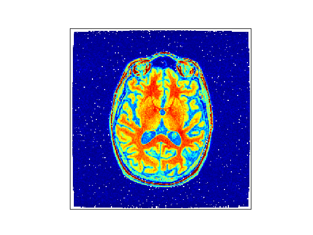 ../_images/sphx_glr_volumetest_001.png